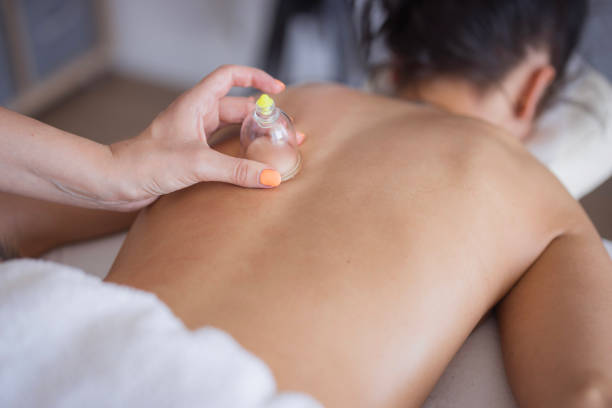 Divae Cupping Massage in IJsselstein
